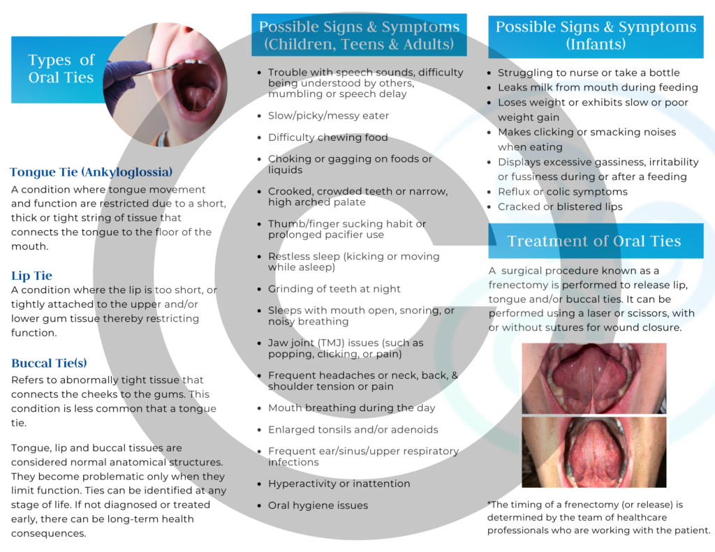 "Oral Ties" Brochure (pack of 50)